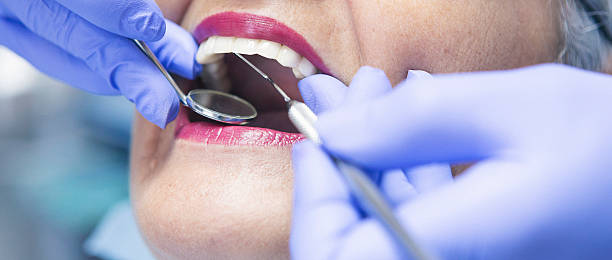 Best Emergency Cosmetic Dentistry (e.g., broken veneers) in Long Beach, CA